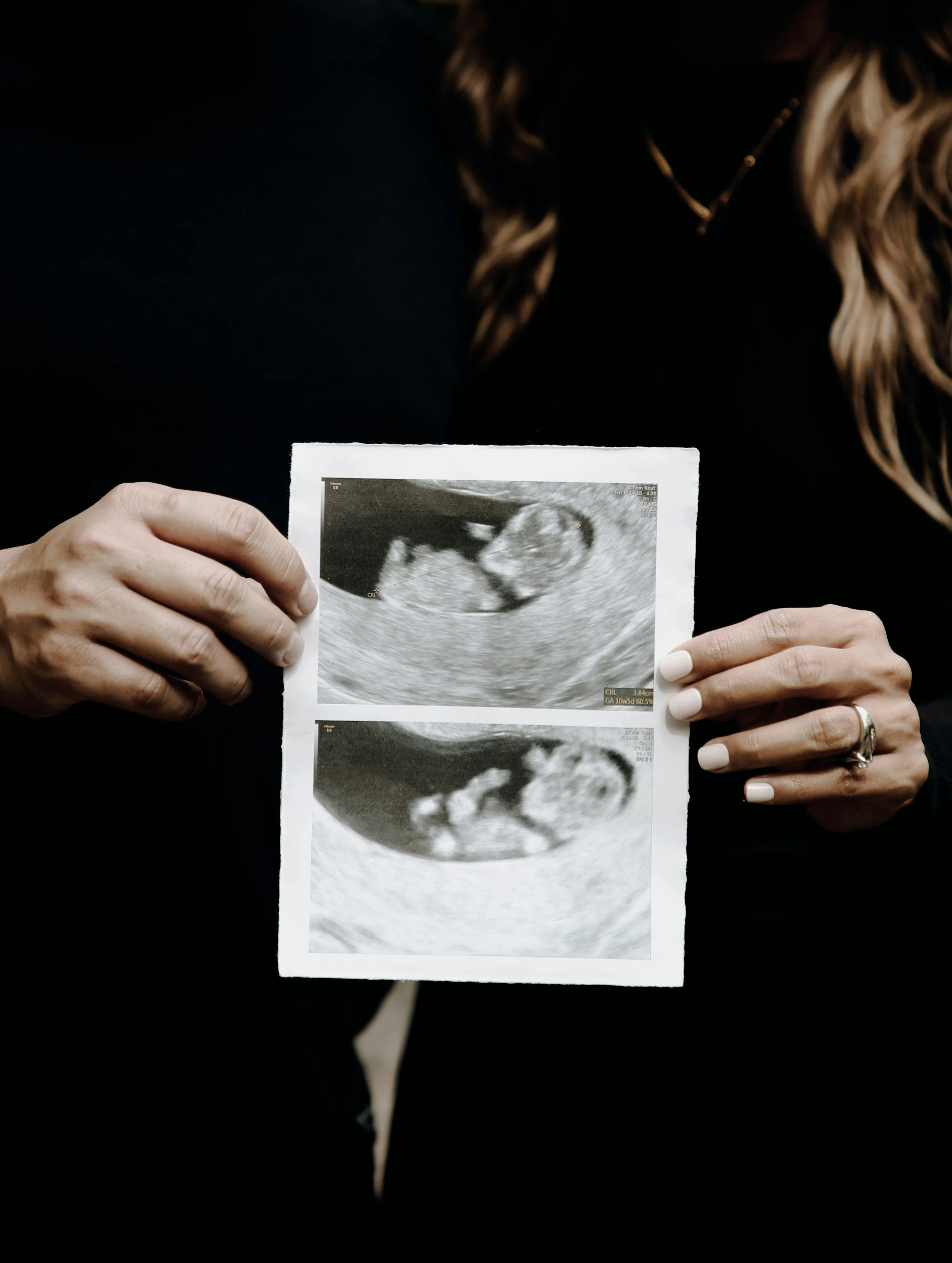 Échographie 12 semaines, lumière chaude